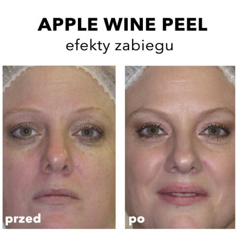 Rhonda Allison Warszawa Peeling winowy anti-age The Apple Wine Peel